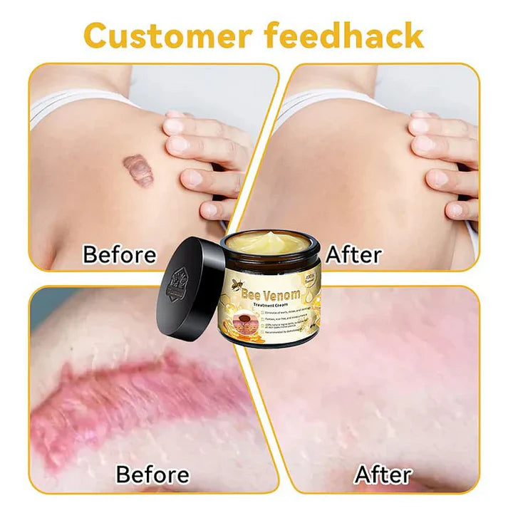 Bee Venom Cream