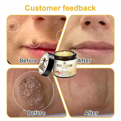 Bee Venom Cream
