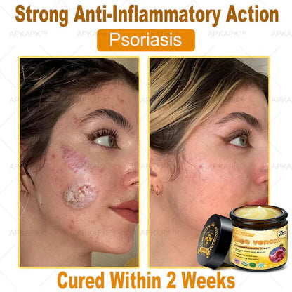 Bee Venom Cream