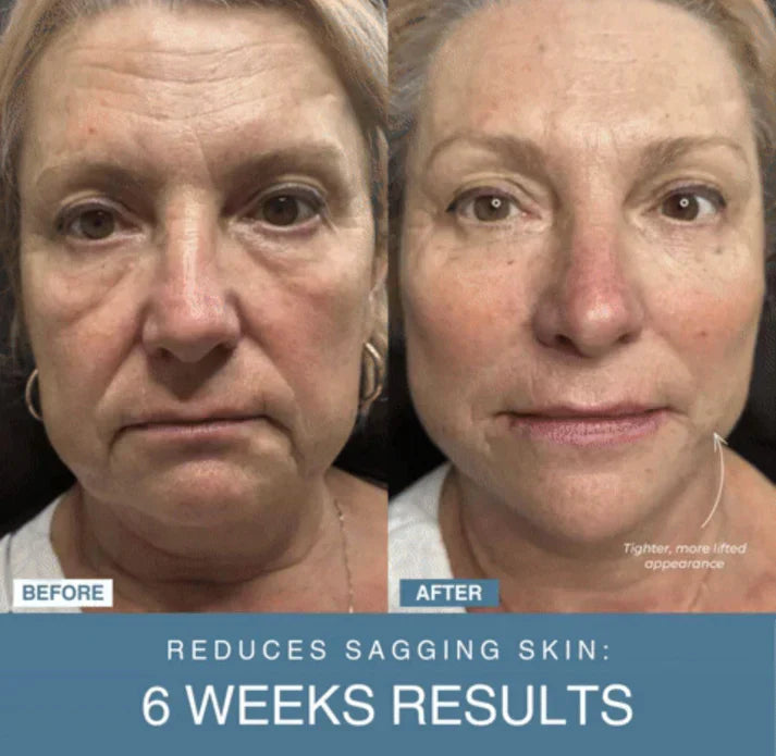 7-in-1 LED Anti-Aging/Wrinkle Apparatus