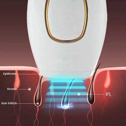IPL Laser Hair Removal